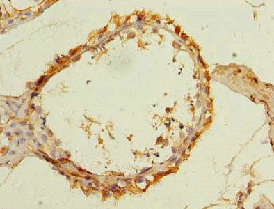 SLC25A33 Antibody