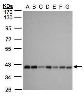SLC25A33 antibody