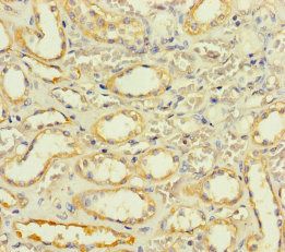 SLC25A35 Antibody
