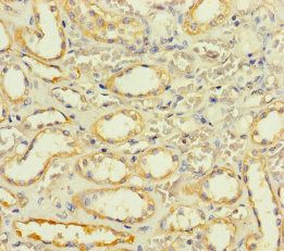 SLC25A35 antibody