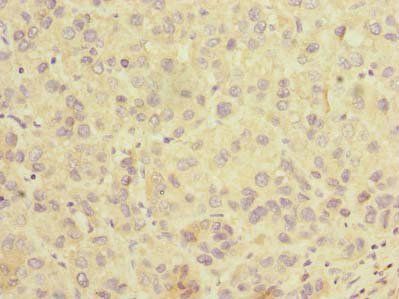 SLC25A36 Antibody