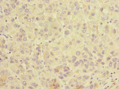 SLC25A36 antibody