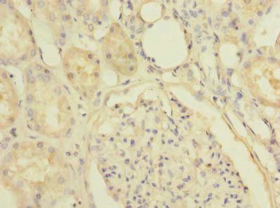 SLC25A36 Antibody