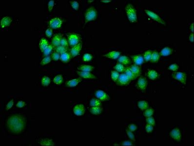 SLC25A4 Antibody