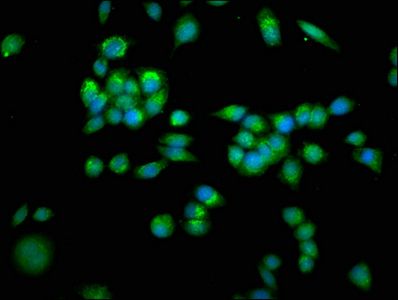 SLC25A4 antibody