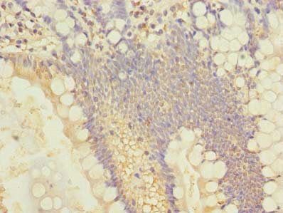 SLC25A4 Antibody