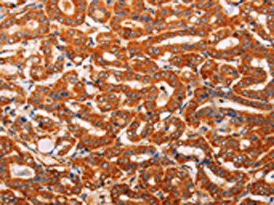 SLC25A4 Antibody