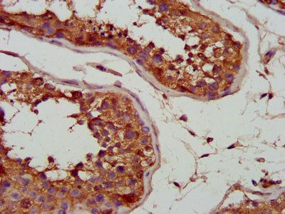 SLC25A5 Antibody