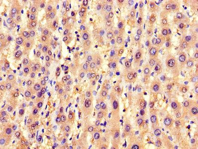 SLC25A6 Antibody