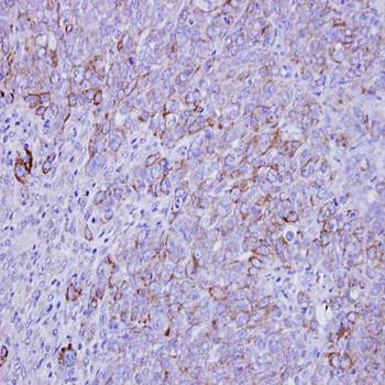 SLC26A8 antibody