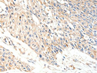 SLC27A1 Antibody