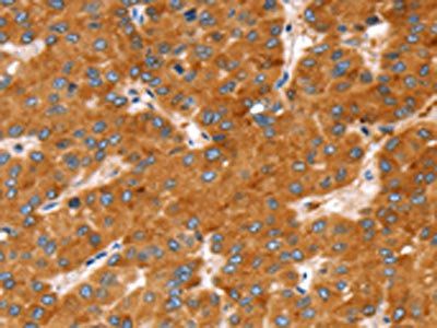 SLC27A2 Antibody
