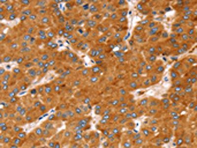 SLC27A2 antibody