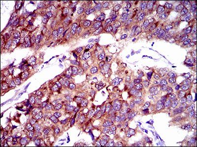 SLC27A2 Antibody