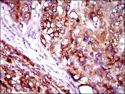 SLC27A2 Antibody