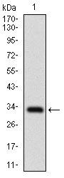 SLC27A2 Antibody