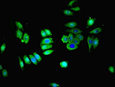 SLC28A1 Antibody