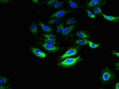 SLC28A1 Antibody