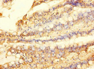 SLC28A1 Antibody