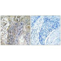 SLC28A2 Antibody