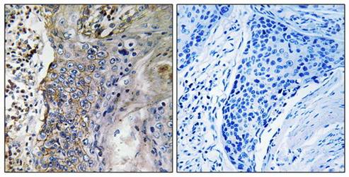 SLC28A2 Antibody