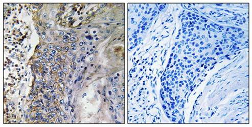 SLC28A2 antibody