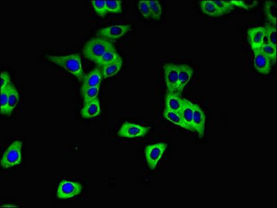 SLC28A3 Antibody