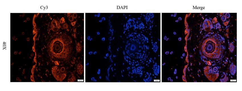 Slc28a3 antibody