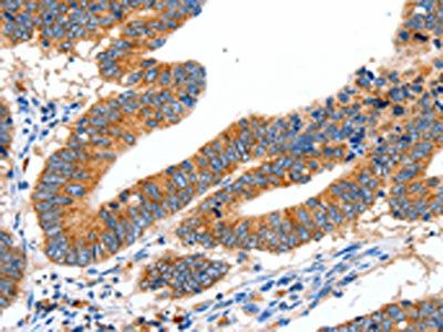 SLC2A1 Antibody