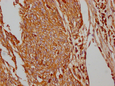 SLC2A1 Recombinant Monoclonal Antibody