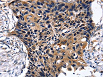 SLC2A2 Antibody