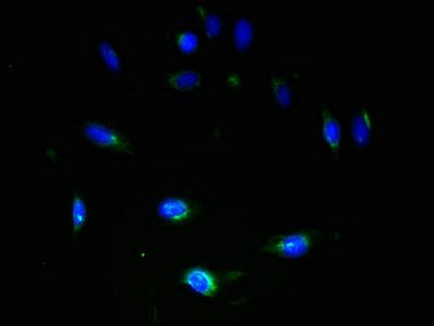 SLC2A4 antibody