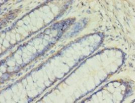 SLC2A4 Antibody