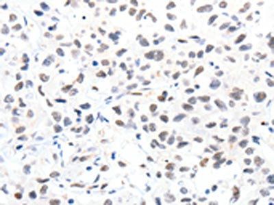 SLC2A4 antibody