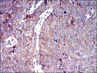 SLC2A4 Antibody