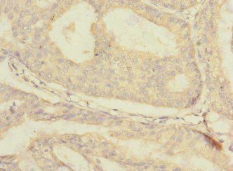 SLC30A1 Antibody