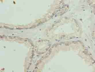 SLC31A2 antibody