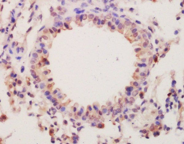 SLC34A2 Rabbit Polyclonal Antibody