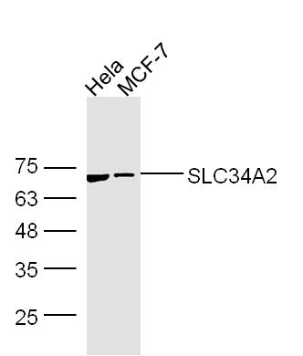 SLC34A2 Rabbit Polyclonal Antibody