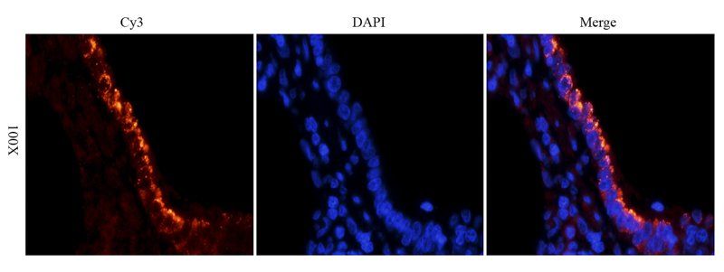 SLC34A2 antibody