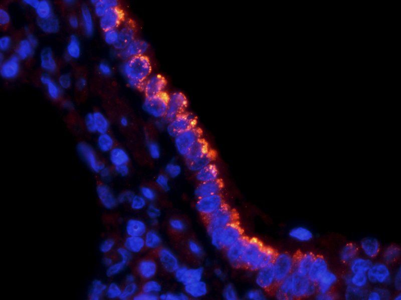 SLC34A2 antibody