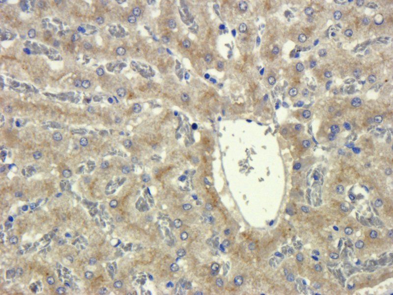 SLC34A2 antibody