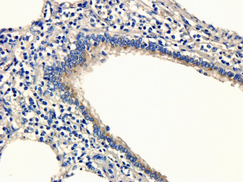 SLC34A2 antibody