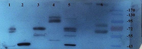 SLC34A2 antibody