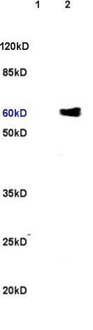 SLC34A2 Rabbit Polyclonal Antibody