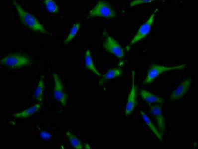 SLC34A3 Antibody