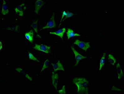 SLC35D3 Antibody