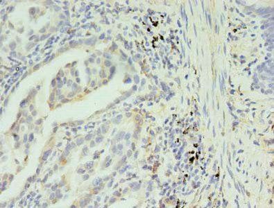 SLC35F5 Antibody