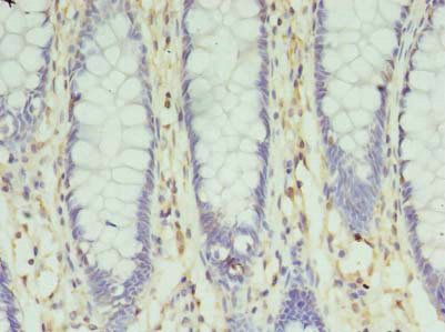 SLC35F5 Antibody