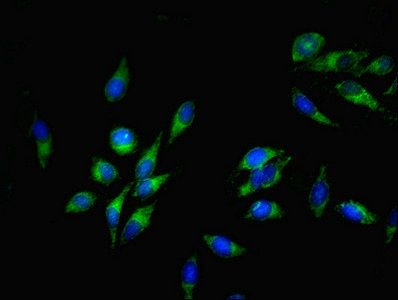SLC35F6 Antibody
